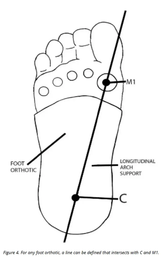 A foot orthotic illustration
