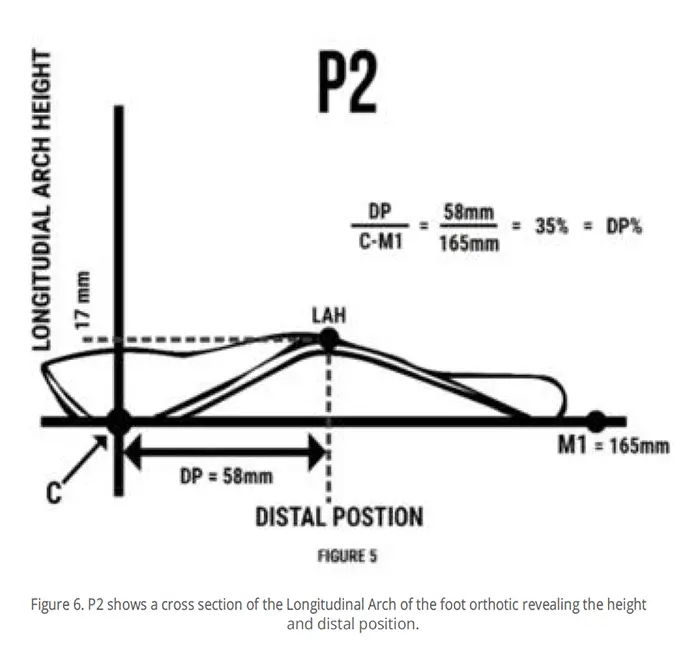 A diagram illustrating the relationship between longitudinal arch height and distal position